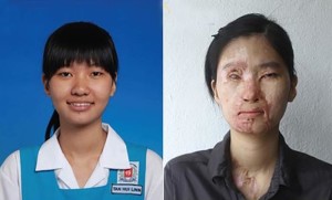 Tan-Hui-Linn-sebelum-selepas